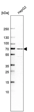 Western blot analysis in human cell line HepG2.