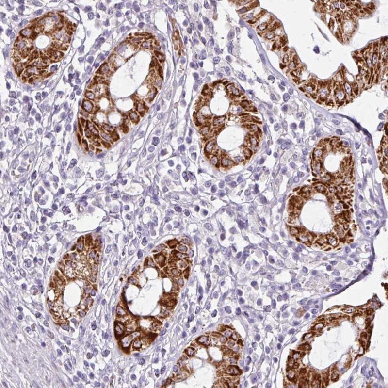 Anti-ANKRD18A Antibody