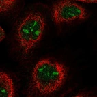 Immunofluorescent staining of human cell line A-431 shows localization to nucleoli.