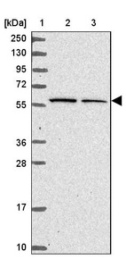 Lane 1: Marker [kDa] 250, 130, 95, 72, 55, 36, 28, 17, 10_br/_Lane 2: Human cell line RT-4_br/_Lane 3: Human cell line U-251MG sp