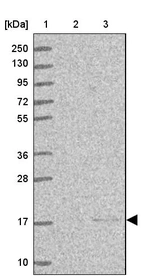 Lane 1: Marker [kDa] 250, 130, 95, 72, 55, 36, 28, 17, 10_br/_Lane 2: Human cell line RT-4_br/_Lane 3: Human cell line U-251MG sp