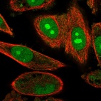 Immunofluorescent staining of human cell line PC-3 shows localization to nucleus & nucleoli.