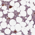 Anti-LAPTM5 Antibody