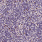 Immunohistochemical staining of human lymph node shows strong granular cytoplasmic positivity in subset of non-germinal center cells.