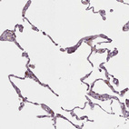 Anti-LAPTM5 Antibody