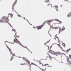 Immunohistochemical staining of human lung shows weak granular cytoplasmic positivity in macrophages.