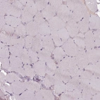 Immunohistochemical staining of human skeletal muscle shows no positivity in myocytes as expected.