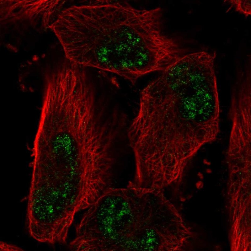 Anti-ADAMTS4 Antibody