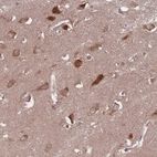 Anti-GABRB1 Antibody
