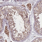 Anti-ZMYM4 Antibody