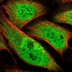 Immunofluorescent staining of human cell line U-2 OS shows localization to nucleoplasm & cytosol.