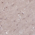 Anti-DAAM2 Antibody