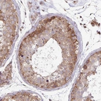 Immunohistochemical staining of human testis shows moderate cytoplasmic positivity in cells in seminiferous ducts.