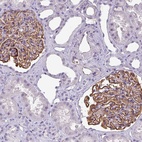 Anti-AREL1 Antibody