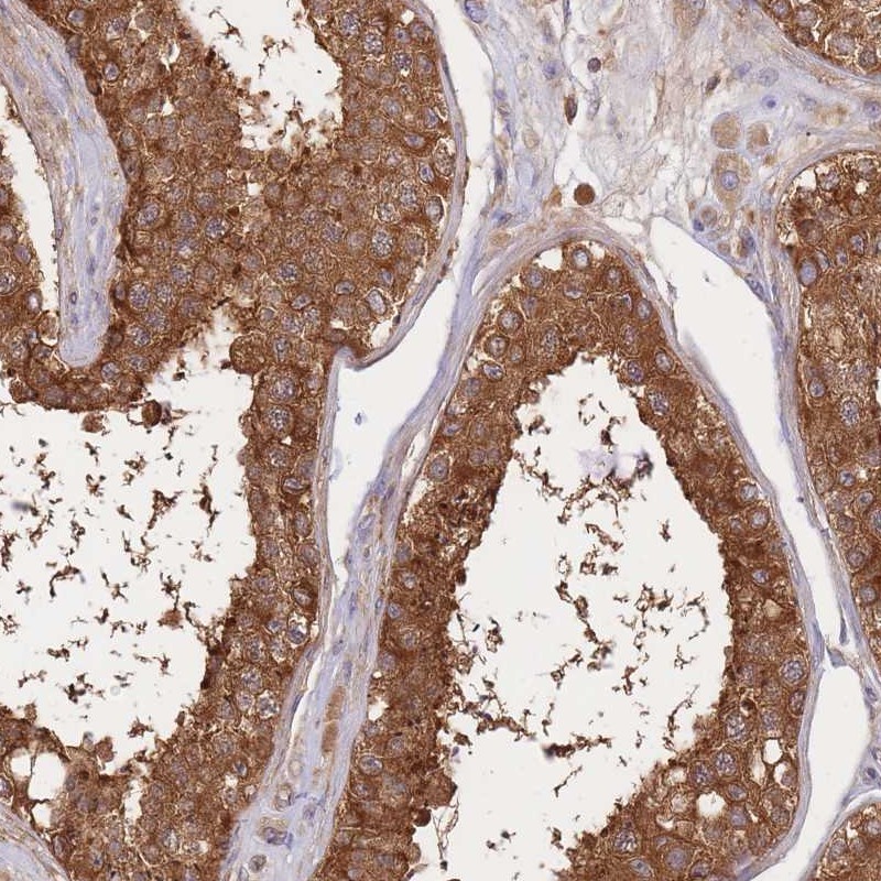 Anti-SLC4A9 Antibody
