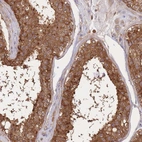 Anti-SLC4A9 Antibody