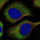 Immunofluorescent staining of human cell line U-2 OS shows localization to cytosol & cytoplasmic bodies.