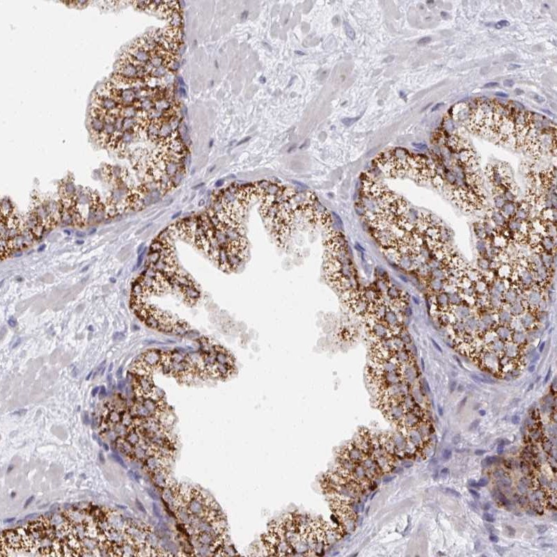 Anti-C18orf25 Antibody