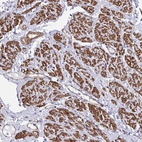 Immunohistochemical staining of human smooth muscle shows high expression.