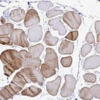 Immunohistochemical staining of human skeletal muscle shows low expression as expected.