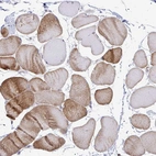 Immunohistochemical staining of human skeletal muscle shows low expression as expected.