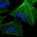 Immunofluorescent staining of human cell line U-251 MG shows localization to plasma membrane, cytosol & actin filaments.