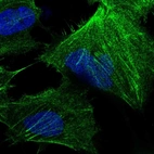 Immunofluorescent staining of human cell line U-251 MG shows localization to plasma membrane, cytosol & actin filaments.