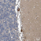 Anti-B3GAT3 Antibody