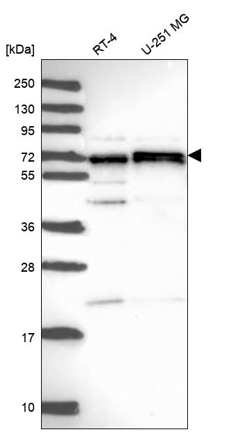Anti-CDK5RAP1 Antibody