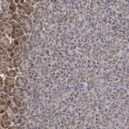 Anti-MTMR12 Antibody