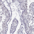Immunohistochemical staining of human testis shows high expression.