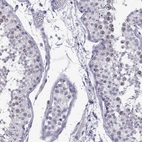 Immunohistochemical staining of human testis shows high expression.