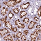 Anti-ATRAID Antibody