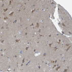 Immunohistochemical staining of human cerebral cortex shows weak cytoplasmic positivity in neurons.
