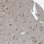 Immunohistochemical staining of human cerebral cortex shows weak cytoplasmic positivity in neurons.