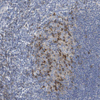 Immunohistochemical staining of human small intestine shows weak cytoplasmic positivity in lymphoid tissue.