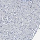 Immunohistochemical staining of human liver shows no positivity in hepatocytes.