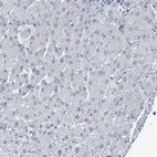 Immunohistochemical staining of human liver shows no positivity in hepatocytes.