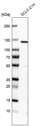 Western blot analysis in human cell line SCLC-21H.