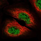Immunofluorescent staining of human cell line A-431 shows localization to nuclear speckles.