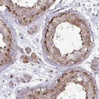 Anti-SPRY1 Antibody
