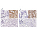 Anti-SYNPR Antibody