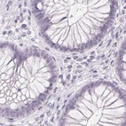 Immunohistochemical staining of human colon using Anti-SYNPR antibody HPA051368.