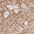 Immunohistochemical staining of human hippocampus using Anti-SYNPR antibody HPA051368.