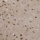 Anti-COQ6 Antibody