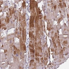 Immunohistochemical staining of human heart muscle shows strong cytoplasmic positivity in cardiomyocytes.