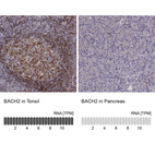 Anti-BACH2 Antibody