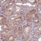 Immunohistochemical staining of human kidney shows moderate cytoplasmic positivity in cells in tubules.