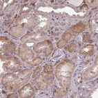Immunohistochemical staining of human kidney shows moderate cytoplasmic positivity in cells in tubules.