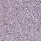 Immunohistochemical staining of human pancreas shows no positivity in exocrine glandular cells as expected.